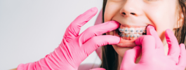  How can dental braces improve a child’s communication?