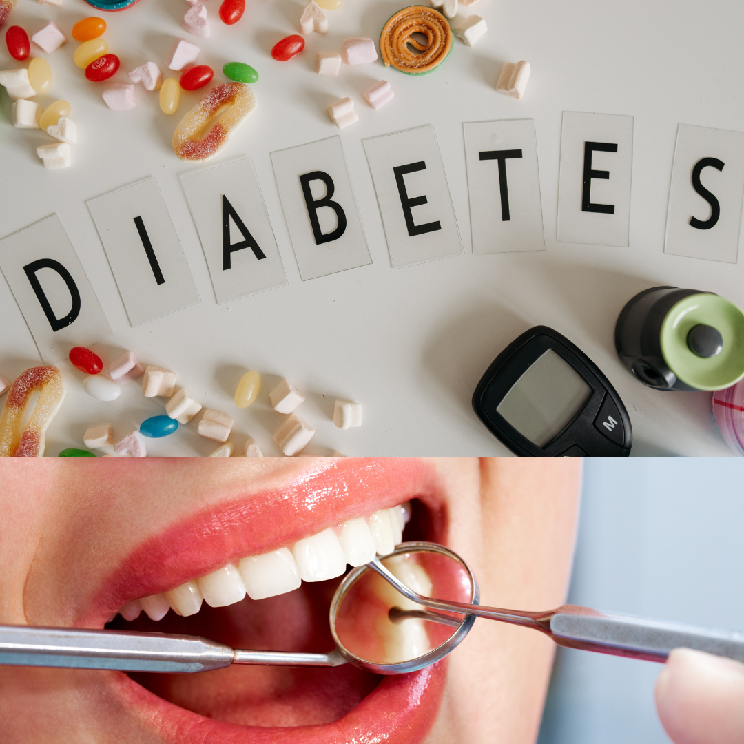 diabetes and dental issues